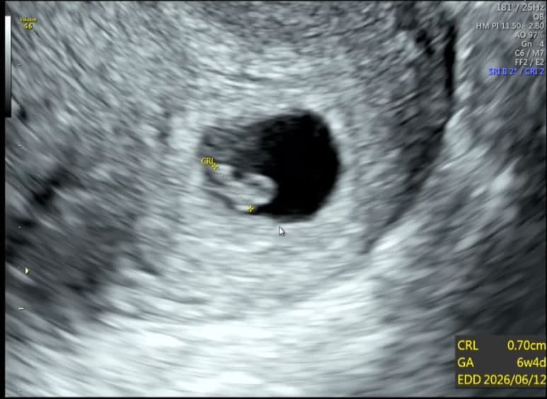 쎄봉이 처음 만난 날