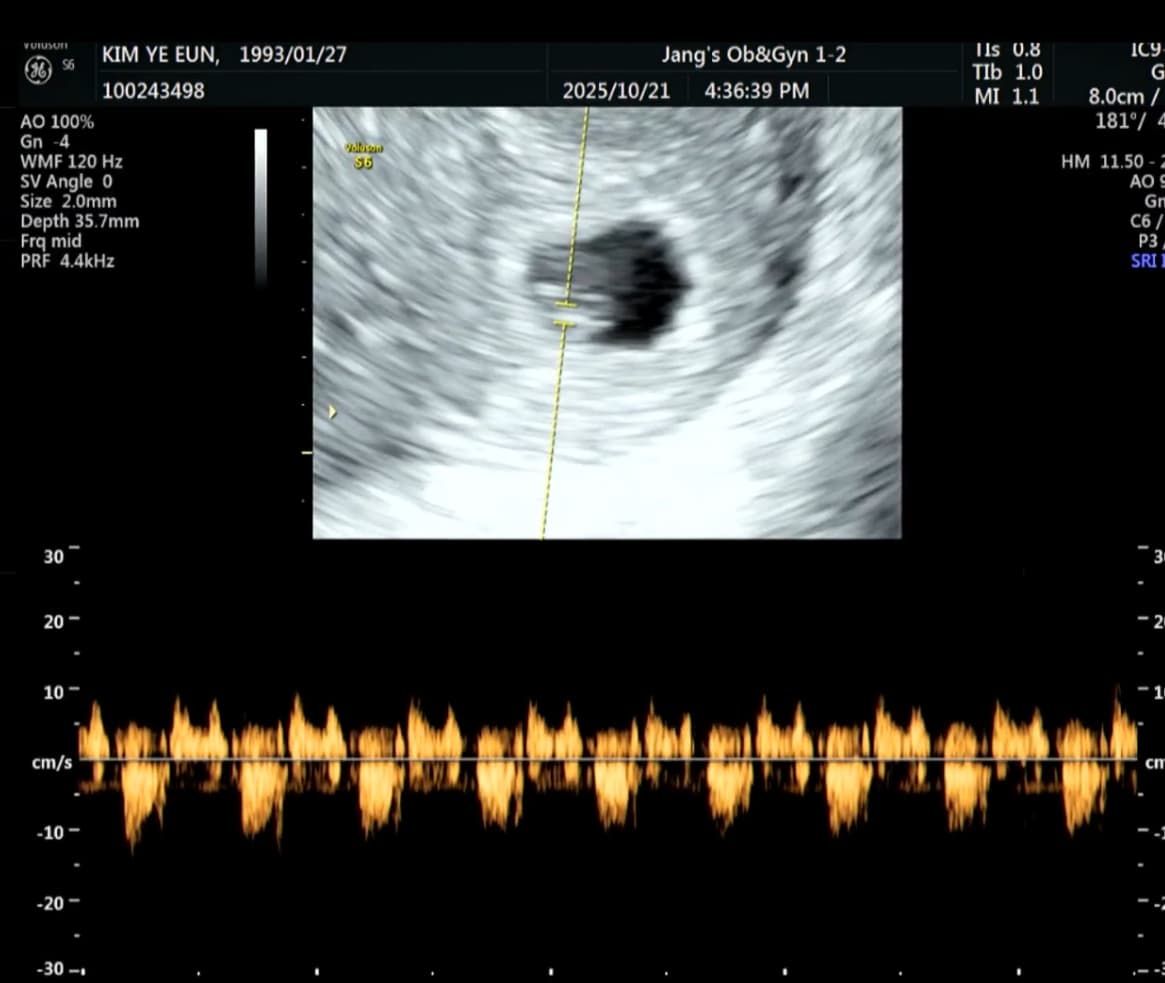 쎄봉이 심장소리